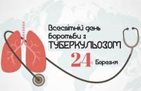 Прев'ю